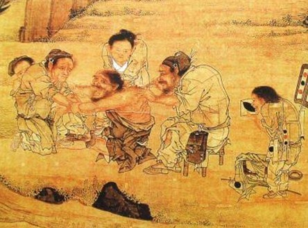 Acupuntura: antiga invenção chinesa